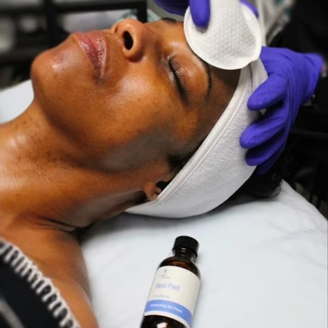 Facial Peel Series at Mobile Bliss By Shar, LLC in Rochester, NY
